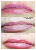 Szkolenie IQ Remover – Masterclass - obrazek 5